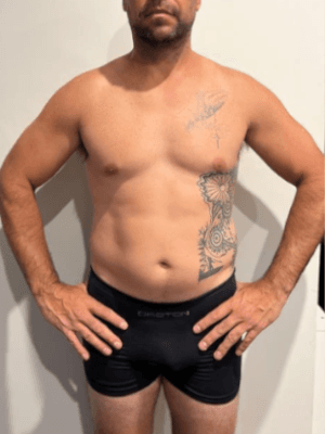 Before transformation