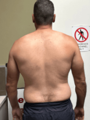 Before transformation